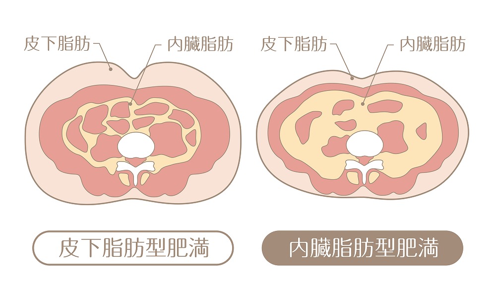 メタボリックシンドローム