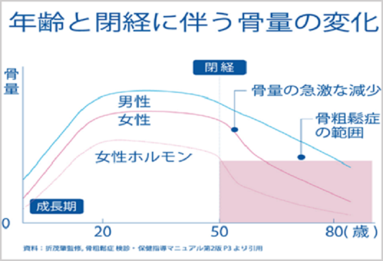 骨粗鬆症