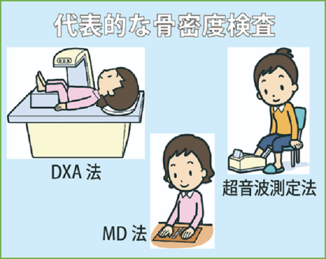 骨密度の測定方法について